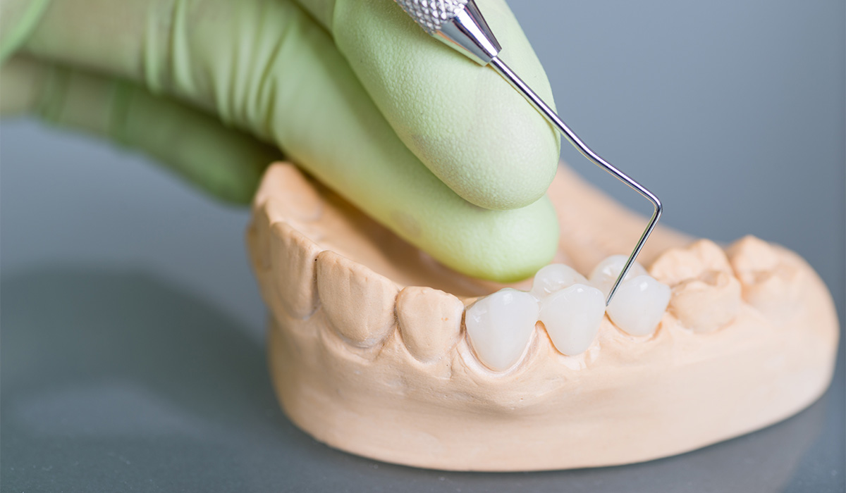  zahnarzt-am-friedensengel_Leistung_Implantatversorgungen_01.jpg